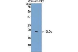 Western blot analysis of the recombinant protein. (RBP7 抗体  (AA 1-134))