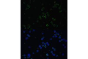Immunofluorescence analysis of Jurkat cells using CD3D antibody (ABIN3021813, ABIN3021814, ABIN3021815 and ABIN6215992) at dilution of 1:100. (CD3D 抗体  (AA 22-105))