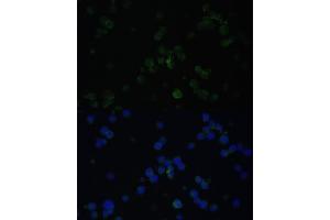 Immunofluorescence analysis of Jurkat cells using CD3D antibody (ABIN3021813, ABIN3021814, ABIN3021815 and ABIN6215992) at dilution of 1:100. (CD3D 抗体  (AA 22-105))