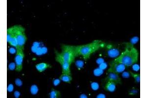 Anti-C20orf30 mouse monoclonal antibody (ABIN2455884) immunofluorescent staining of COS7 cells transiently transfected by pCMV6-ENTRY C20orf30 (RC201878). (C20orf30 抗体)