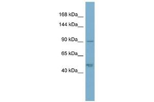 Plakophilin 2 antibody used at 1 ug/ml to detect target protein. (Plakophilin 2 抗体  (N-Term))