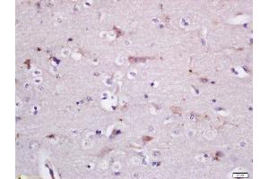 Immunohistochemistry (Paraffin-embedded Sections) (IHC (p)) image for anti-Protein Phosphatase 1, Regulatory (Inhibitor) Subunit 15A (PPP1R15A) (AA 401-500) antibody (ABIN2174278)