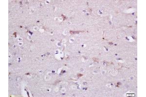 Formalin-fixed and paraffin embedded rat brain labeled with Rabbit Anti-GADD34 Polyclonal Antibody, Unconjugated (ABIN2174278) at 1:200 followed by conjugation to the secondary antibody and DAB staining (GADD34 抗体  (AA 401-500))