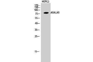Western Blotting (WB) image for anti-Solute Carrier Family 25 (Mitochondrial Carrier, Aralar), Member 12 (Slc25a12) (Internal Region) antibody (ABIN6283510)