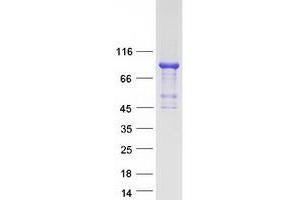 Validation with Western Blot