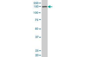 SMARCC1 polyclonal antibody (A01), Lot # 051012JC01 Western Blot analysis of SMARCC1 expression in SJCRH30 .