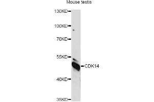 Western blot analysis of extracts of mouse testis, using CDK14 antibody (ABIN6292456) at 1:1000 dilution. (CDK14 抗体)