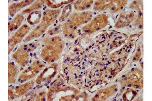 IHC image of ABIN7145029 diluted at 1:500 and staining in paraffin-embedded human kidney tissue performed on a Leica BondTM system. (KCNJ8 抗体  (AA 299-424))