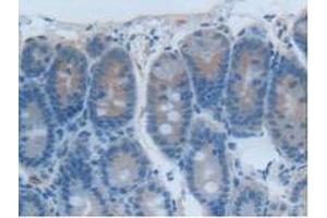 IHC-P analysis of Rat Intestine Tissue, with DAB staining. (CEACAM1 抗体  (AA 36-145))