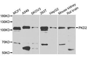 Western blot analysis of extracts of HEK-293 cell line, using PKD2 antibody. (PKD2 抗体  (AA 240-410))