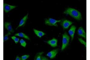 Immunofluorescence (IF) image for anti-Torsin Family 1, Member A (Torsin A) (TOR1A) (AA 33-321) antibody (ABIN7443317)