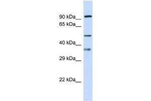 Host: Rabbit Target Name: SGSH Sample Type: 721_B Whole Cell lysates Antibody Dilution: 1. (SGSH 抗体  (N-Term))
