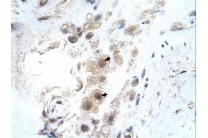 KIAA0494 antibody was used for immunohistochemistry at a concentration of 4-8 ug/ml. (KIAA0494 抗体  (N-Term))