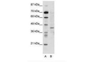 Image no. 1 for anti-Ring Finger Protein 1 (RING1) (N-Term) antibody (ABIN202445) (RING1 抗体  (N-Term))