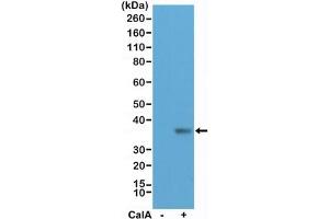 Western blot testing of lysate from human HeLa cells, untreated (-) or treated (+) with Calyculin A (CalA), with recombinant phospho-EIF2A antibody at 1:200 dilution.
