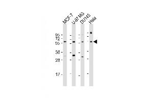 All lanes : Anti-RGS3 Antibody (N-Term) at 1:1000 dilution Lane 1: MCF-7 whole cell lysate Lane 2: U-87 MG whole cell lysate Lane 3: D whole cell lysate Lane 4: Hela whole cell lysate Lysates/proteins at 20 μg per lane.
