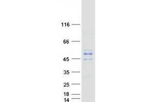 Validation with Western Blot
