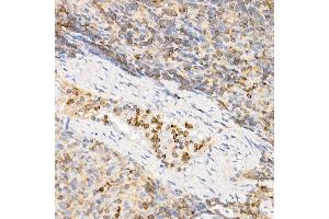 Immunohistochemistry (IHC) image for anti-Interleukin 21 (IL21) (AA 25-162) antibody (ABIN6142359)