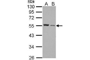 WB Image Desmin antibody detects DES protein by Western blot analysis. (Desmin 抗体)