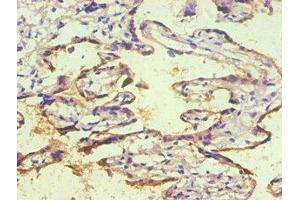 Immunohistochemical of paraffin-embedded human placenta tissue using ABIN7140934 (2E11-2B5) at dilution of 1:200. (CD59 抗体)