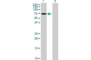Western Blot analysis of ZNF449 expression in transfected 293T cell line by ZNF449 MaxPab polyclonal antibody. (ZNF449 抗体  (AA 1-518))