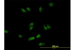 Immunofluorescence of monoclonal antibody to CSE1L on HeLa cell. (Exportin 2 抗体  (AA 872-971))