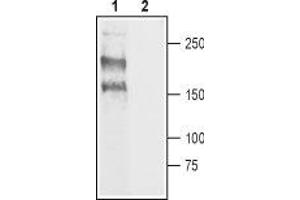 Western blot analysis of rat DRG lysate: - 1. (Nav1.8 抗体  (C-Term, Intracellular))
