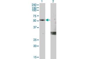 Western Blot analysis of MYOC expression in transfected 293T cell line by MYOC monoclonal antibody (M02), clone 2B4. (MYOC 抗体  (AA 1-504))