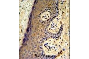 Forlin-fixed and paraffin-embedded hun skin reacted with FF Antibody (Center), which was peroxidase-conjugated to the secondary antibody, followed by DAB staining. (MafF 抗体  (AA 66-92))