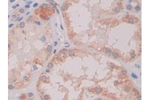 Immunohistochemistry (IHC) image for anti-Cross-Linked C-Telopeptides of Type I Collagen (CTX-I) antibody (ABIN7427822)