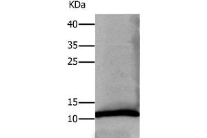 Western Blot analysis of Human lung tissue using DEFA1 Polyclonal Antibody at dilution of 1:550 (alpha Defensin 1 抗体)