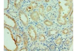 Immunohistochemistry of paraffin-embedded human kidney tissue using ABIN7169100 at dilution of 1:100 (NEK2 抗体  (AA 1-135))