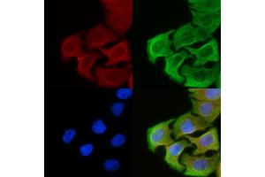ABIN6258881 and ABIN6276082 staining Hela cells(30 min of UV treatment) by IF/ICC.