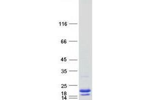 Western Blotting (WB) image for TSC22 Domain Family, Member 3 (TSC22D3) (Transcript Variant 2) protein (Myc-DYKDDDDK Tag) (ABIN2734436)