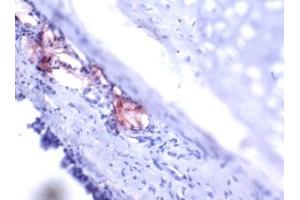 Immunohistochemistry (IHC) image for anti-Trefoil Factor 1 (TFF1) (AA 57-84), (C-Term) antibody (ABIN781662) (TFF1 抗体  (C-Term))