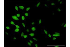 Immunofluorescence of purified MaxPab antibody to CISH on HeLa cell. (CISH 抗体  (AA 1-258))