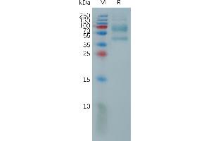 Interleukin 9 (IL9) (AA 19-144) protein (Fc Tag)
