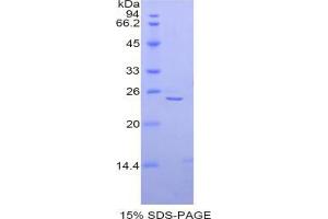 SDS-PAGE analysis of Mouse alpha Fodrin Protein. (SPTAN1 蛋白)