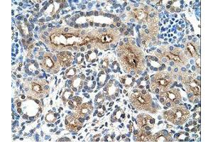 Image no. 1 for anti-C-Type Lectin Domain Family 4, Member M (CLEC4M) (AA 51-100) antibody (ABIN203419)