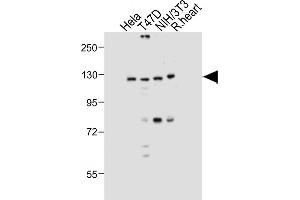 All lanes : Anti-Dnmt3a Antibody at 1:1000 dilution Lane 1: Hela whole cell lysate Lane 2: T47D whole cell lysate Lane 3: NIH/3T3 whole cell lysate Lane 4: Rat heart tissue lysate Lysates/proteins at 20 μg per lane. (DNMT3A 抗体  (AA 457-486))