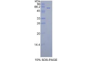 SDS-PAGE analysis of Rat FGL1 Protein. (FGL1 蛋白)