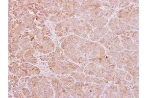 IHC-P Image Calcium binding protein P22 antibody [N2C2], Internal detects Calcium binding protein P22 protein at cytoplasm on SW480 xenograft by immunohistochemical analysis. (CHP 抗体  (Internal Region))