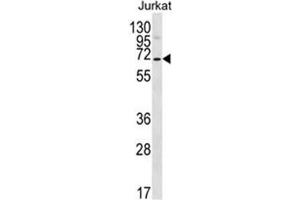 Western blot analysis of PSAPL1 Antibody (N-term) in Jurkat cell line lysates (35ug/lane).