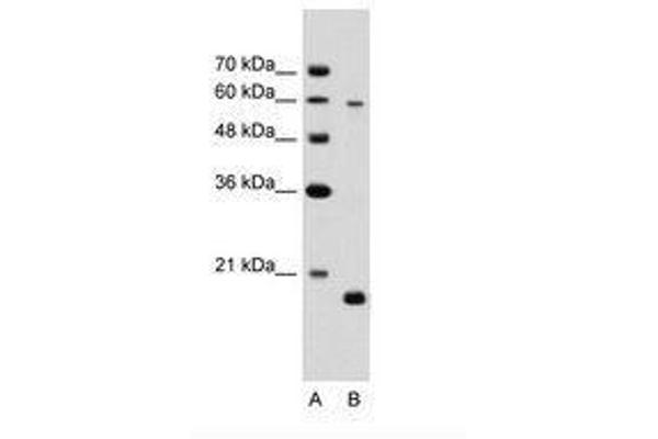 SLC38A4 抗体  (AA 381-430)