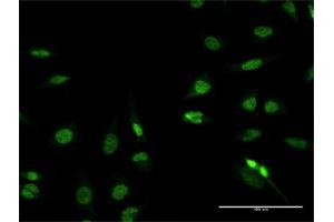 Immunofluorescence of purified MaxPab antibody to RFX2 on HeLa cell. (RFX2 抗体  (AA 1-723))