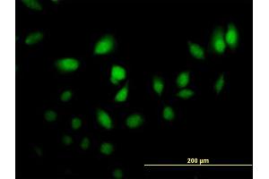 Immunofluorescence of purified MaxPab antibody to CRABP2 on HeLa cell. (CRABP2 抗体  (AA 1-138))