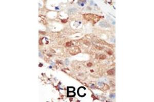Immunohistochemistry (Paraffin-embedded Sections) (IHC (p)) image for anti-Phosphoinositide 3 Kinase, p85 beta (PI3K p85b) (AA 268-298), (C-Term) antibody (ABIN392575)