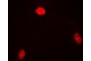 Immunofluorescent analysis of TARDBP staining in SW620 cells. (TARDBP 抗体)