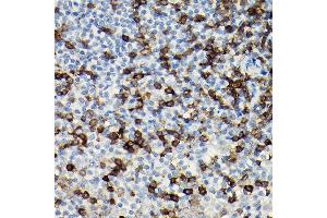 Immunohistochemistry of paraffin-embedded Human tonsil using CD3H antibody (ABIN3022812, ABIN3022813, ABIN3022814 and ABIN6219240) at dilution of 1:100 (40x lens).