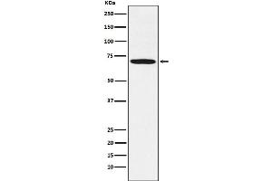 Western blot analysis of LIM Kinase 1 expression in U-87MG cell lysate.